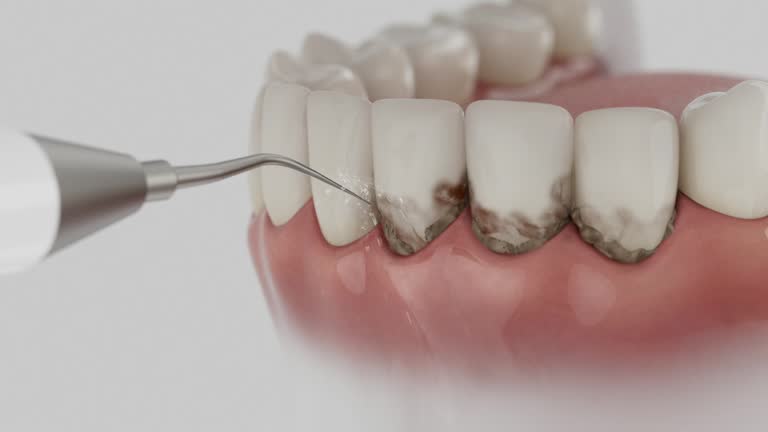 Reliable Dental contractor in Highlands, TX by Smile Center Dentistry